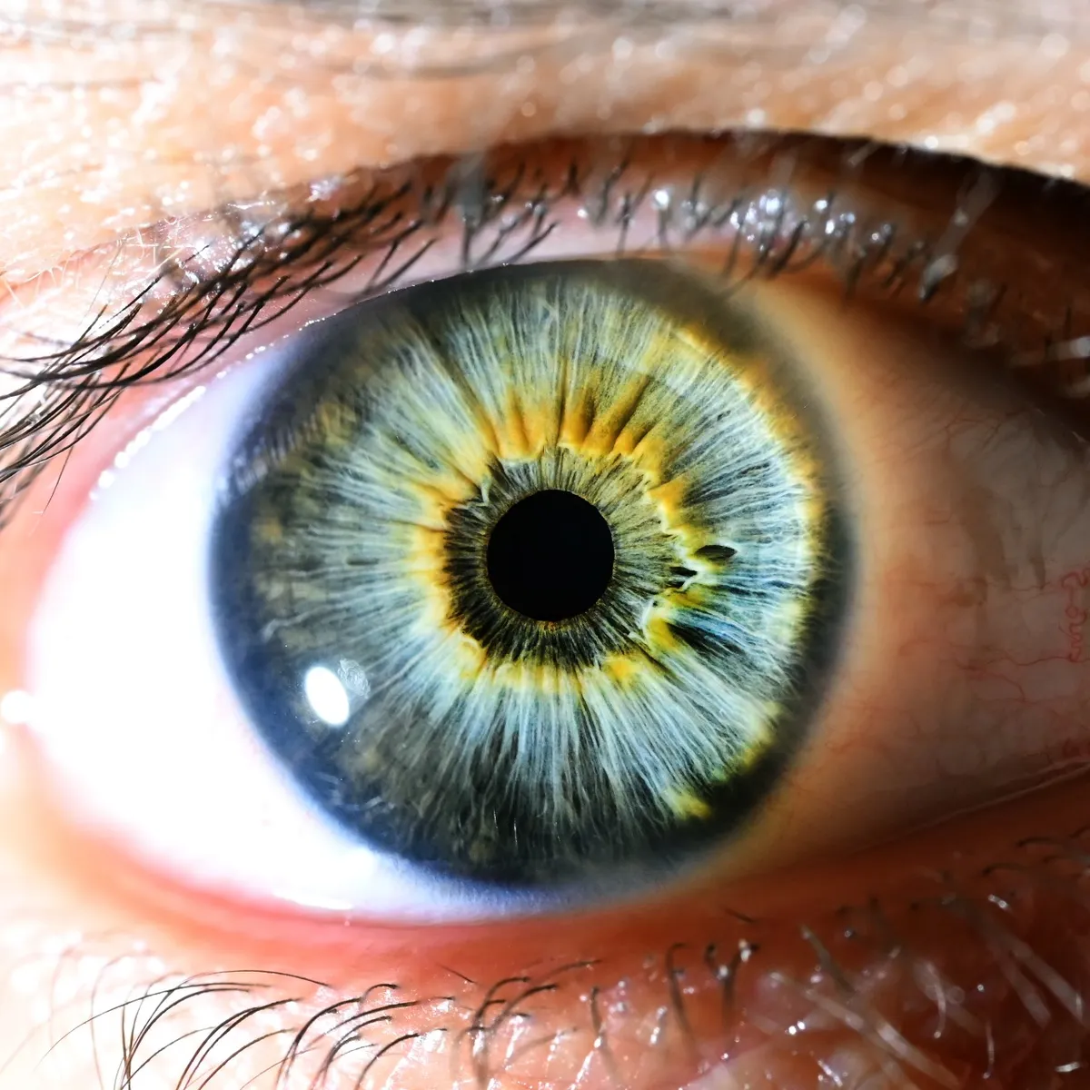 Close-up of an eye with a blue-grey iris and a gold ring around the pupil